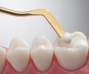 الحشوات التجميلية